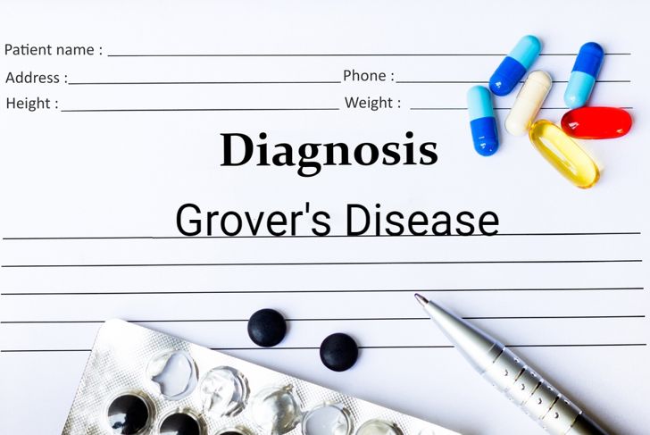 Grover's Disease: A Rare Skin Disorder