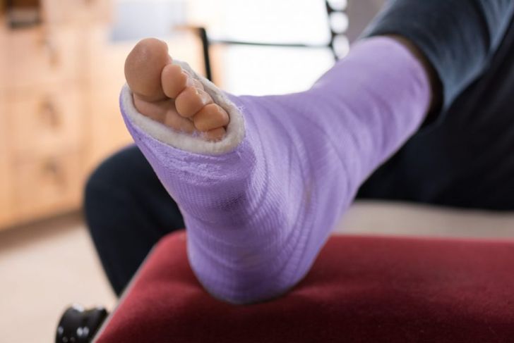 How to Care for March Fractures