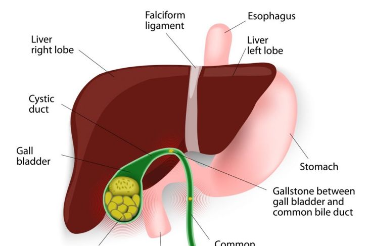 How To Recognize the Onset of a Gallbladder Attack