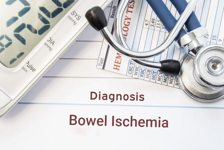 Ischemia in the Brain, Heart, and Bowel
