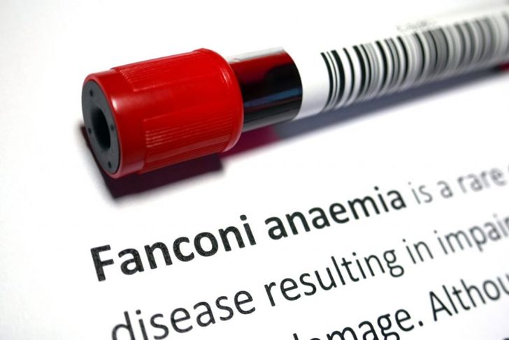 Kidney Filtration and Fanconi Syndrome