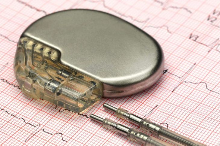 Living With a Pacemaker