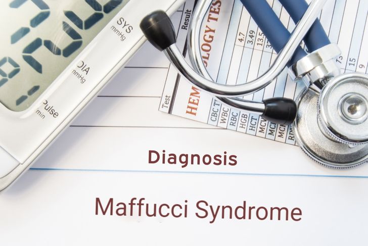 Maffucci Syndrome: Causes, Symptoms, and Treatment