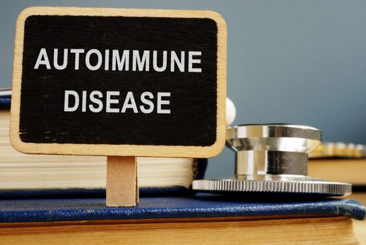 Mixed Connective Tissue Disease: An Autoimmune Overlap Disease