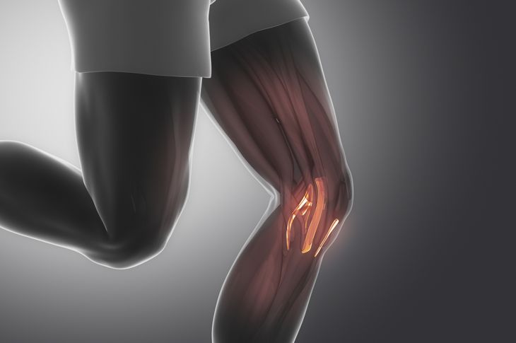 PCL Injury Questions Answered