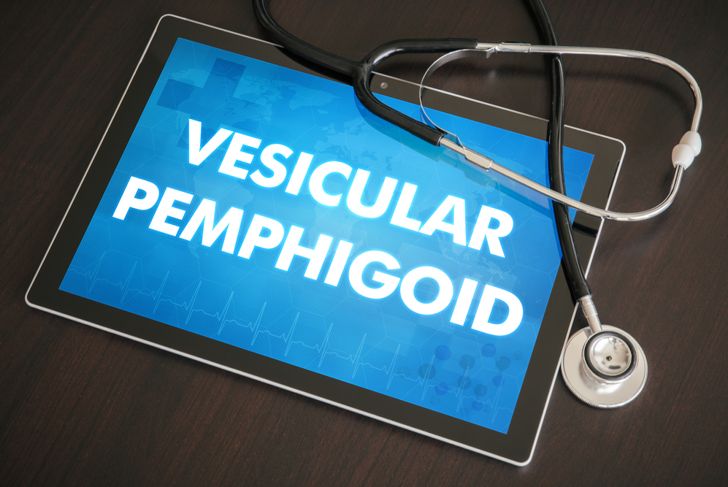 Pemphigoid: Symptoms, Causes, and Treatments