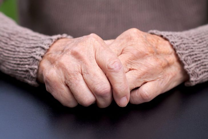 Reactive Arthritis: Symptoms, Causes, and Treatments