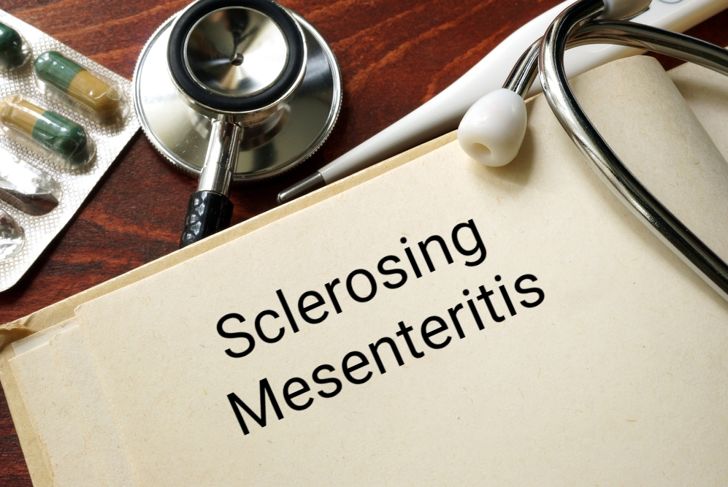 Sclerosing Mesenteritis: A Rare Gastrointestinal Disease