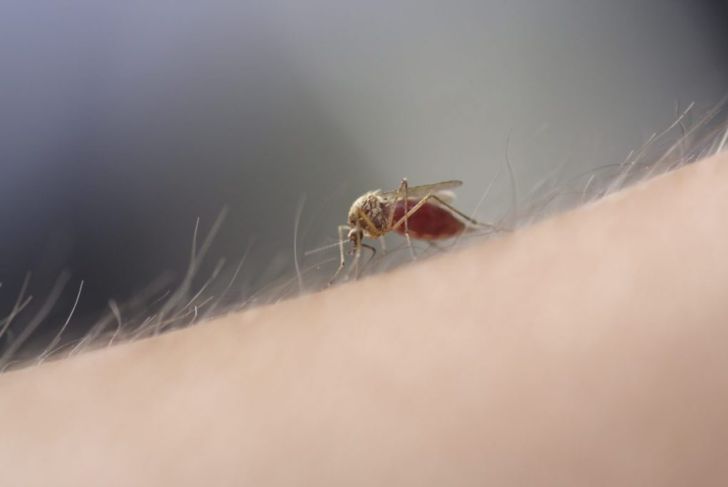 Severe Mosquito Bites: Skeeter Syndrome