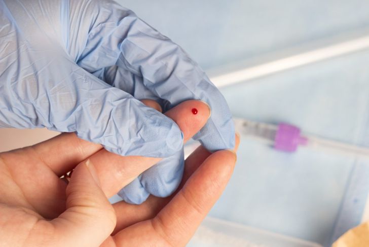 Should You Be Concerned About Your Blood Blister?