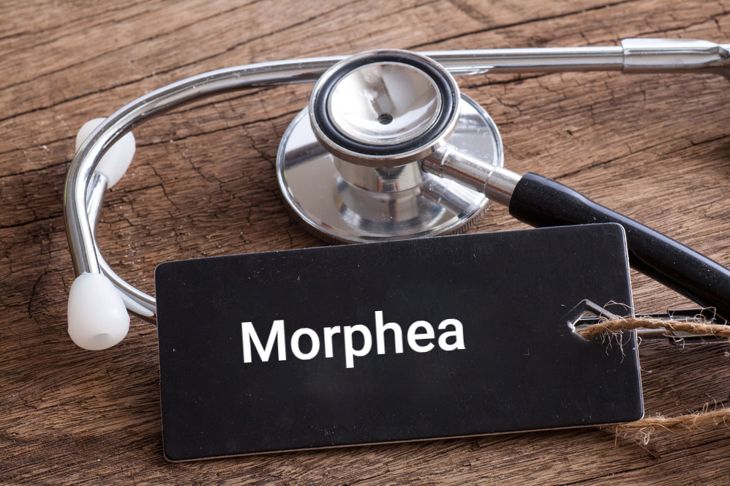 Signs, Causes, and Treatments of Morphea