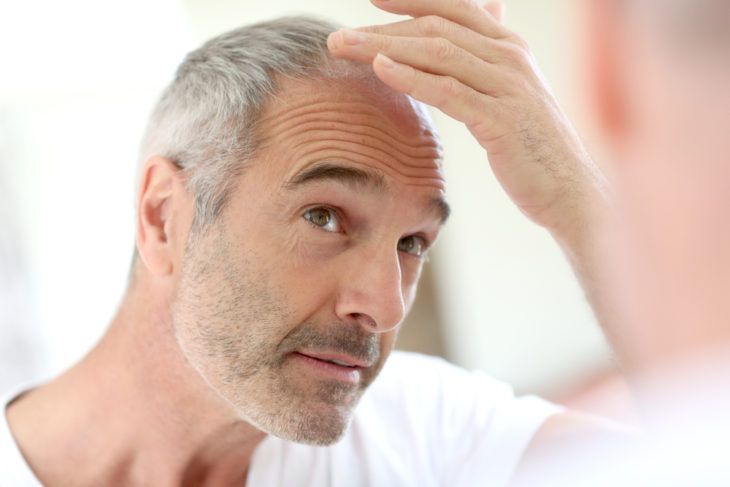 Surgical vs. Non-Surgical Hair Replacement in 2021 + Pros & Cons of Each