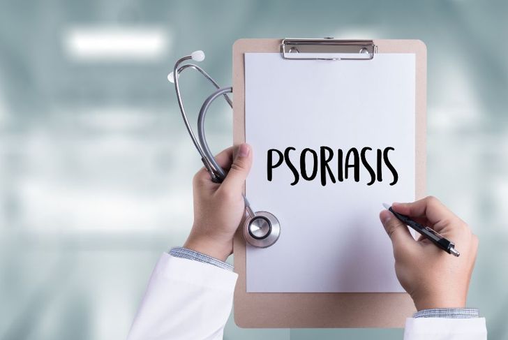 Symptoms and Treatments of Guttate Psoriasis