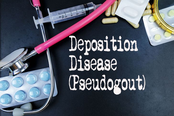 Symptoms and Treatments of Pseudogout