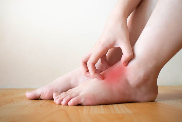 Symptoms of Staph Infection
