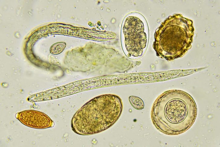 The 10 Most Common Parasitic Infections