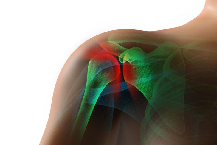 The Causes and Effects of Shoulder Impingement