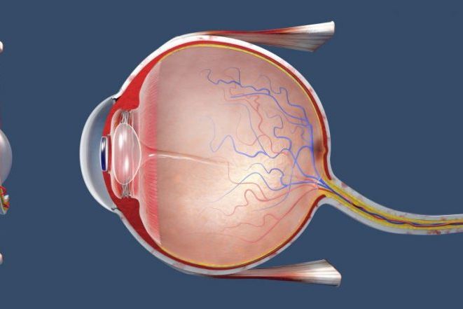 The Many Causes and Symptoms of Ophthalmoplegia