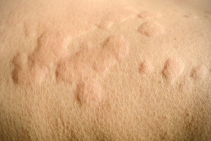 The Most Common Types of Skin Lesions
