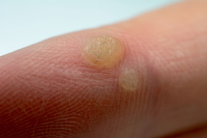 The Skinny On The Most Common Skin Diseases