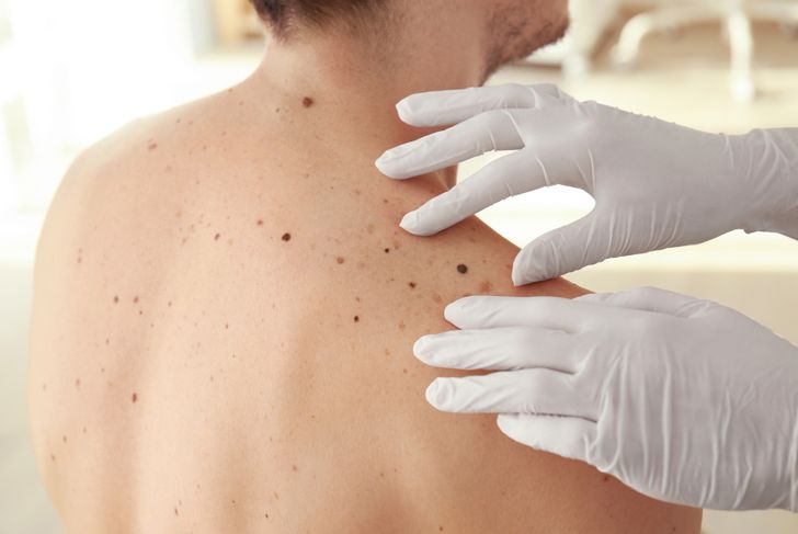 The Skinny On The Most Common Skin Diseases