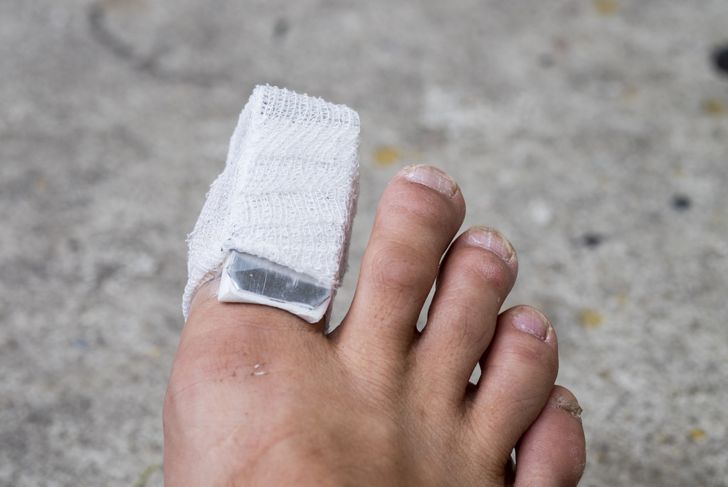 Things to Know About Broken Toes