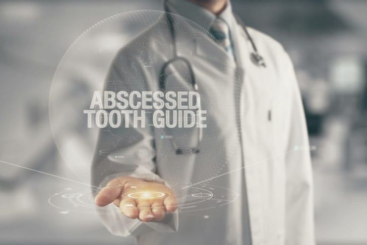 Tooth Abscess: Types, Causes, Complications