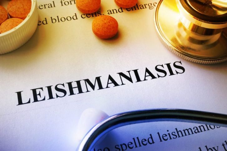 Top 10 Frequently Asked Questions About Leishmaniasis