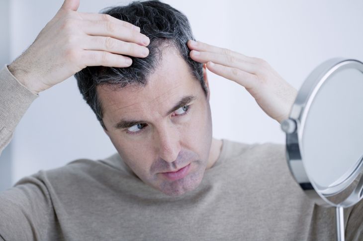 Top Causes of Hair Loss in Men