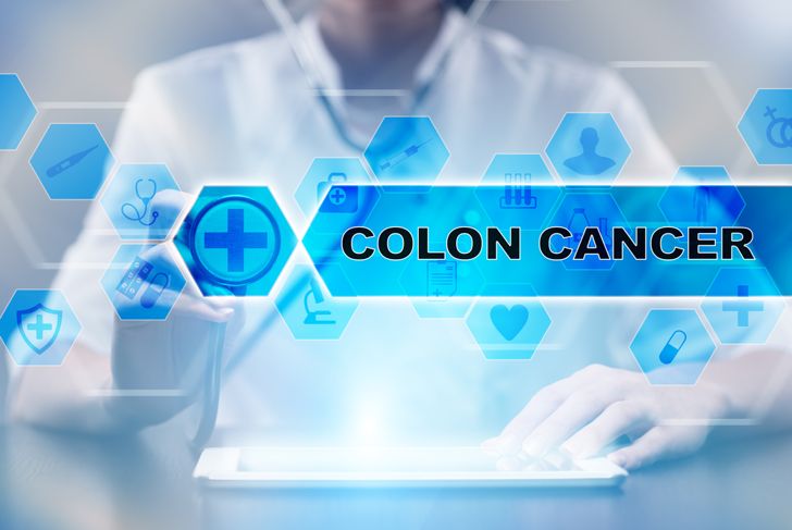 Treatments for Colon Cancer Based on the Stage