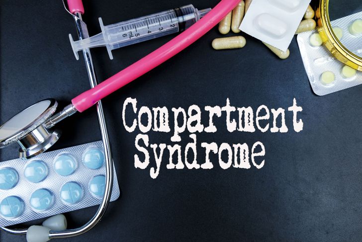 Treatments for Compartment Syndrome