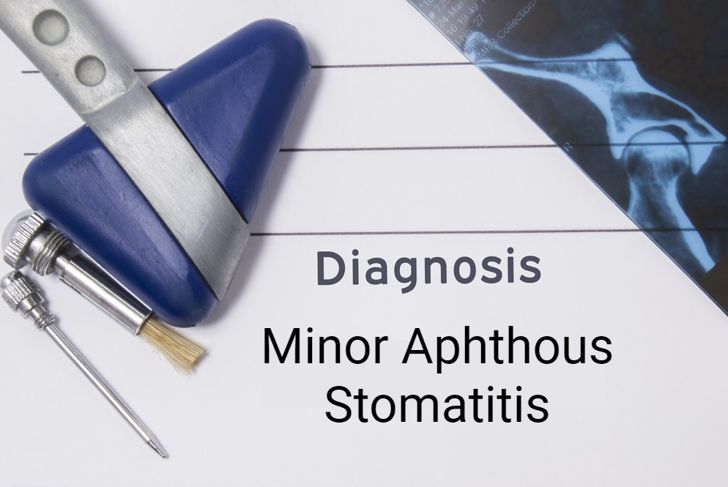 Types of Stomatitis and What to Do