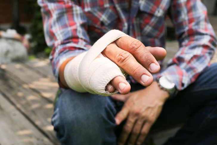 Understanding a Boxer's Fracture of the Hand