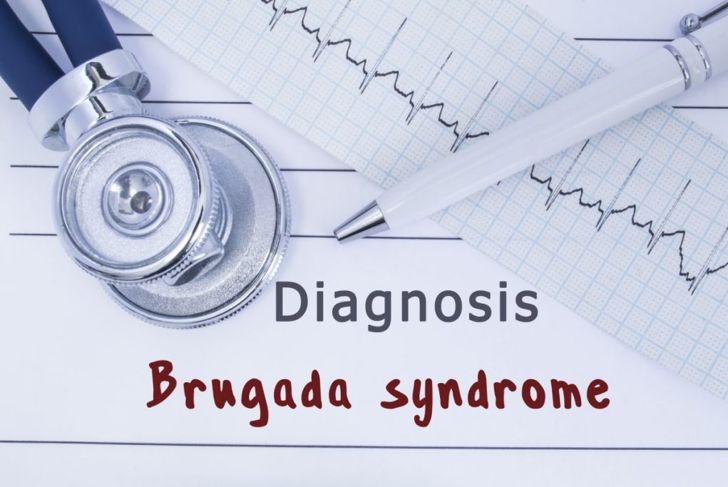 Understanding More About Brugada Syndrome