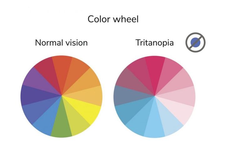 Understanding the Spectrum of Color Blindness