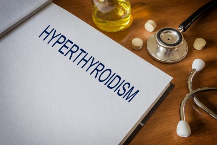 Untreated Hyperthyroidism Can Lead to a Thyroid Storm