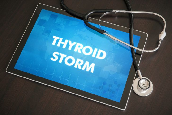 Untreated Hyperthyroidism Can Lead to a Thyroid Storm