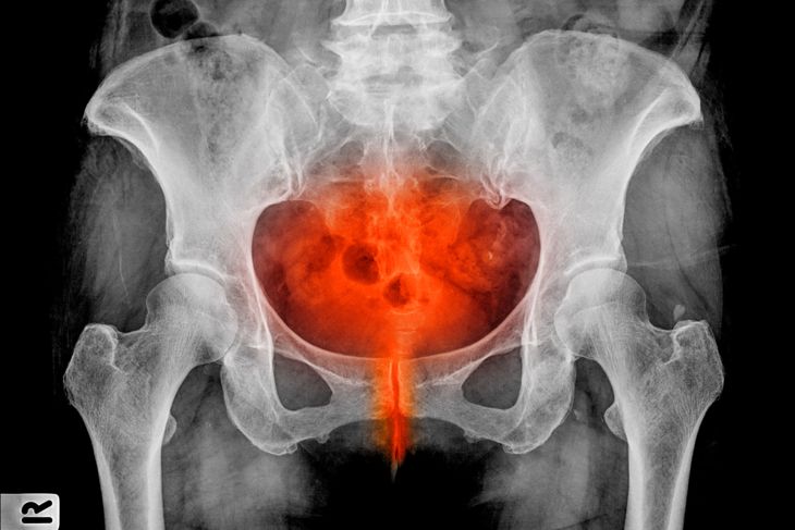 Urinary Incontinence: 10 Terms You Need To Know Today