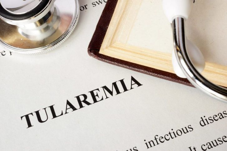 What Are the Causes, Symptoms, and Treatments of Tularemia?