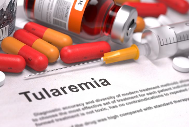 What Are the Causes, Symptoms, and Treatments of Tularemia?