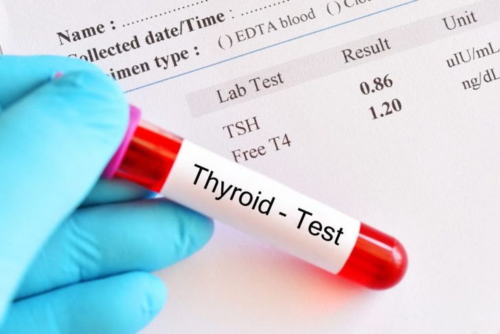 What Do Blood Test Results Mean?