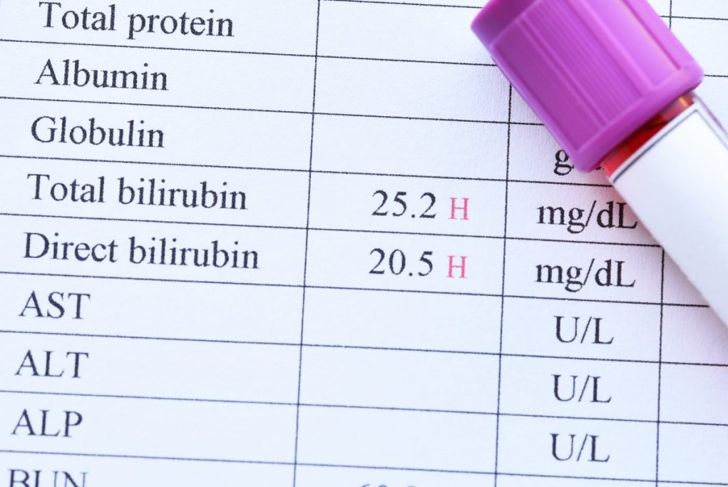 What Do High and Low Bilirubin Levels Mean?