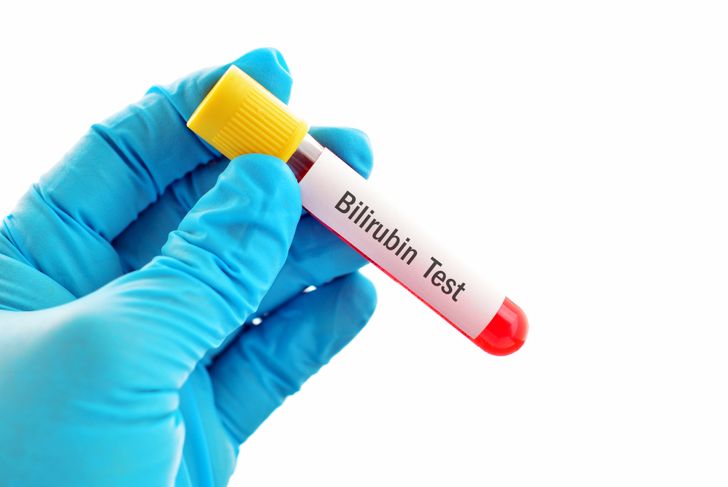 What Do High and Low Bilirubin Levels Mean?