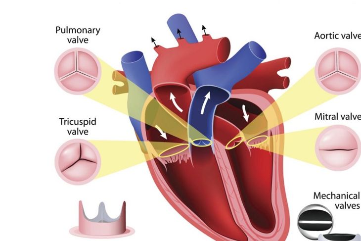 What Is Aortic Valve Insufficiency?