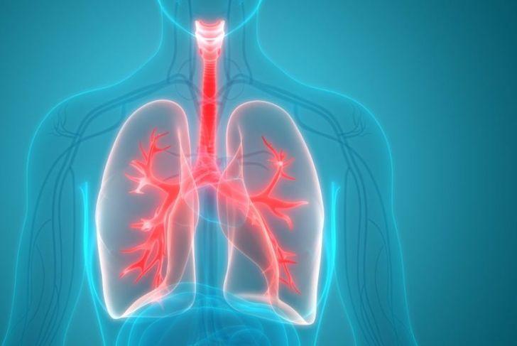 What is Black Lung Disease?