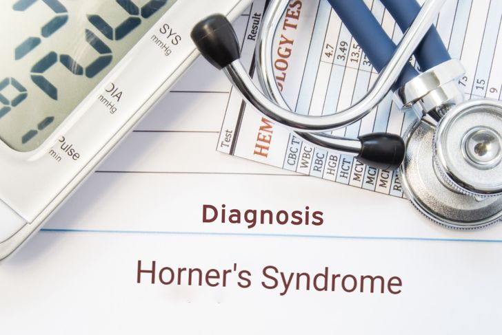What Is Horner's Syndrome?