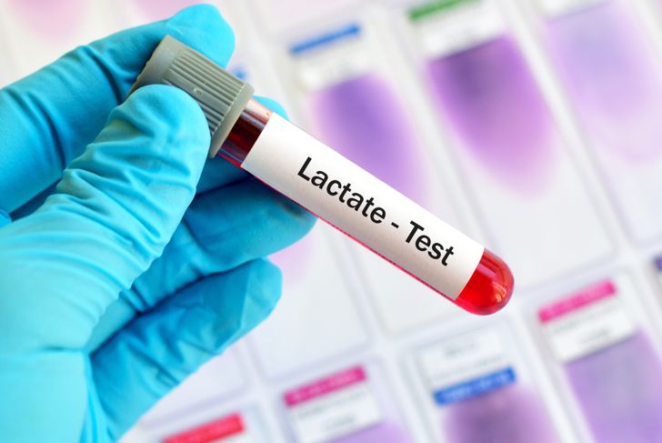What is Lactic Acidosis?