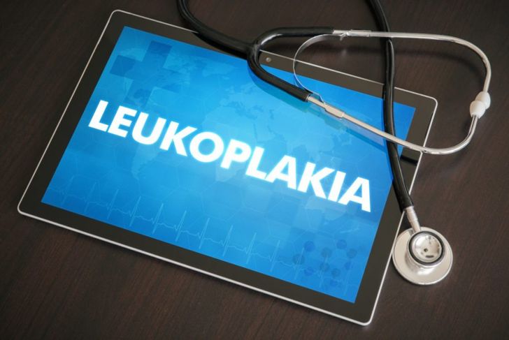 What is Leukoplakia?