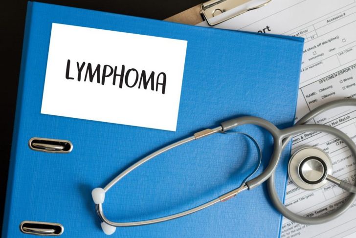 What is Lymphoma?