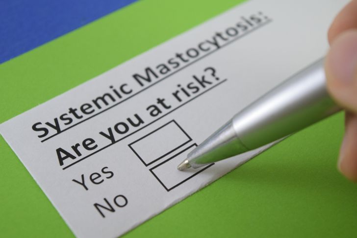What is Mastocytosis? Symptoms and Treatments